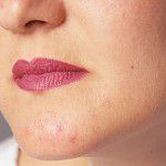 Pickel und Akne abdecken – Camouflage Make-up schminken